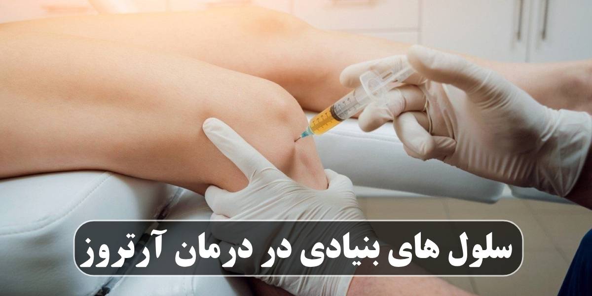 سلول های بنیادی در درمان آرتروز