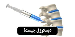 دیسکوژل چیست