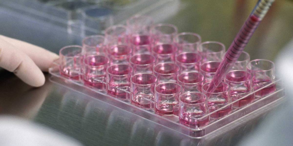 تزریق سلول های بنیادی در درمان آرتروز