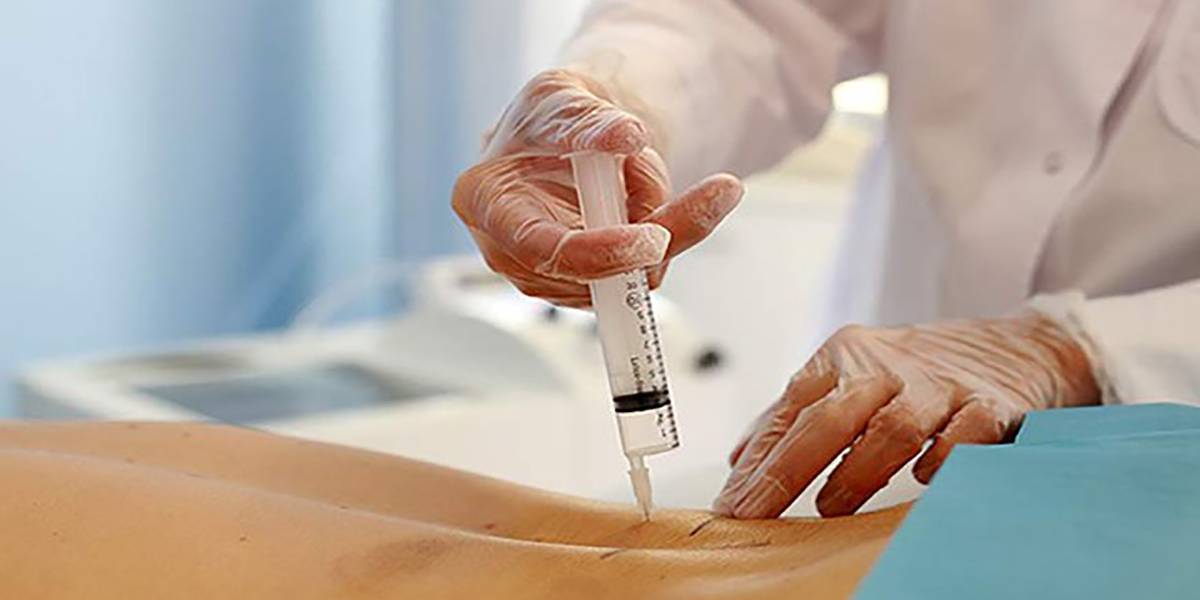 مزایای دیسکوژل چیست 