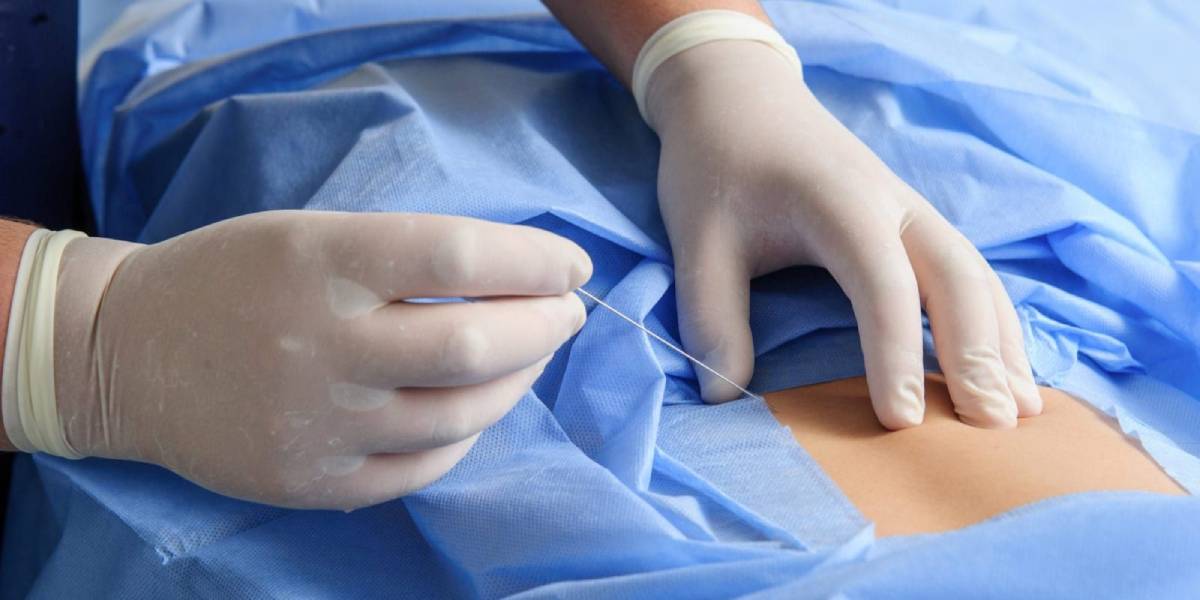 مزایای بلاک عصبی چیست