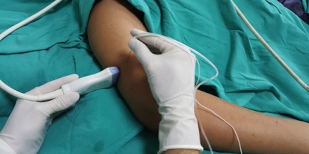 مراحل اجرای بلاک عصبی چیست