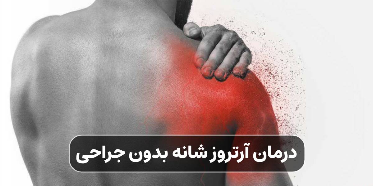 درمان آرتروز شانه بدون جراحی