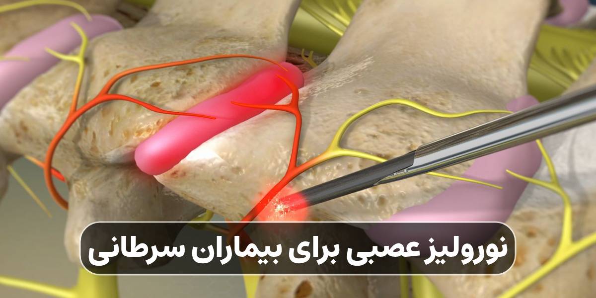 نورولیز عصبی برای بیماران سرطانی