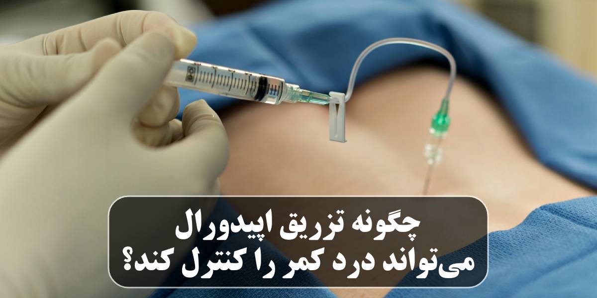 تزریق اپیدورال چیست