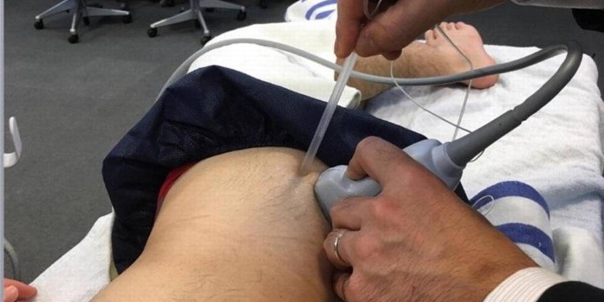 بلاک عصبی چیست