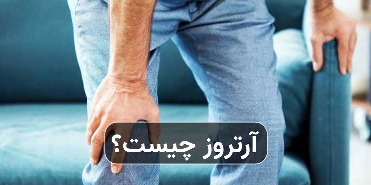 آرتروز چیست