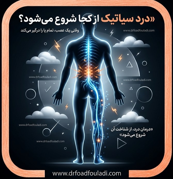 درد سیاتیک